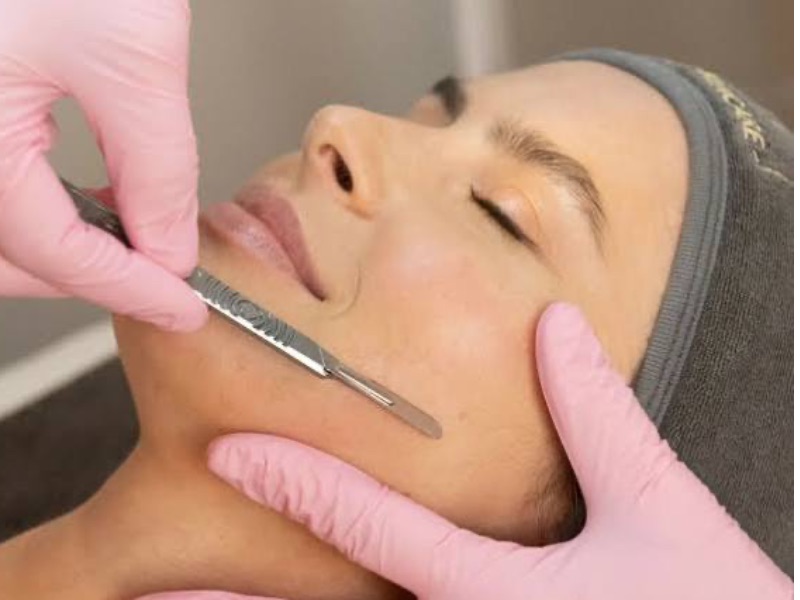 Dermaplaning